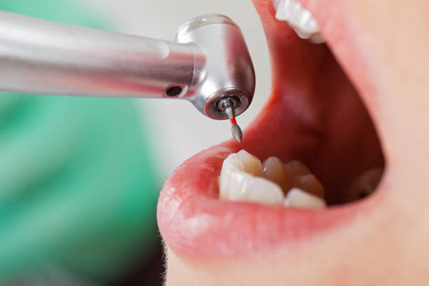 Best Urgent Care for Lost Fillings or Crowns in Coal Valley, IL